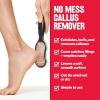 imageRevlon Callus Remover Foot File for Wet or Dry Skin Pedicure ToolsGently Removed Callus and Dead Skin Easy to Use Pack of 1